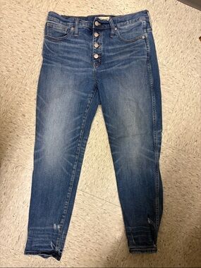 Madewell Button-Fly Skinny Jeans in Medium Blue Wash